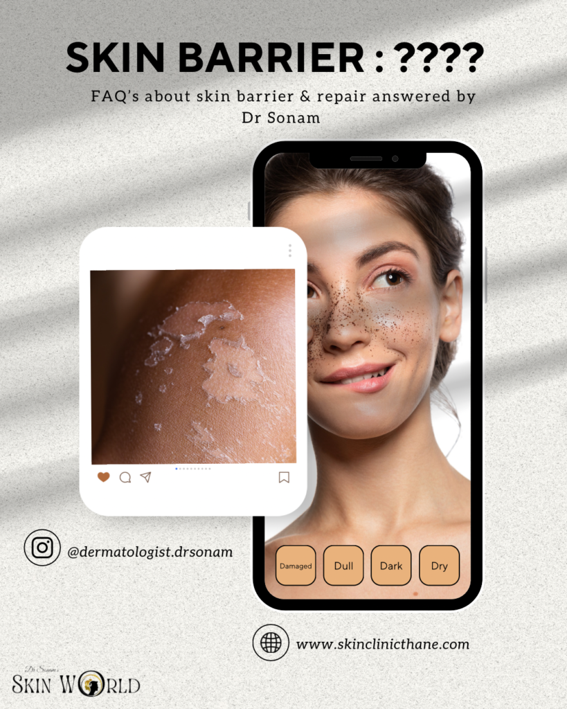 Skin Barrier